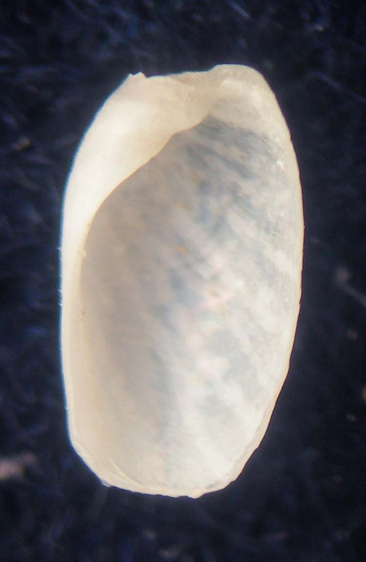 philine denticulata???